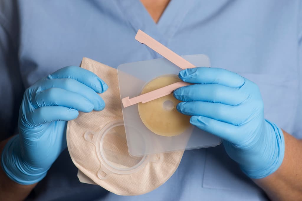 Limpieza profesional de ostomías en Ferrol, Narón y Fene