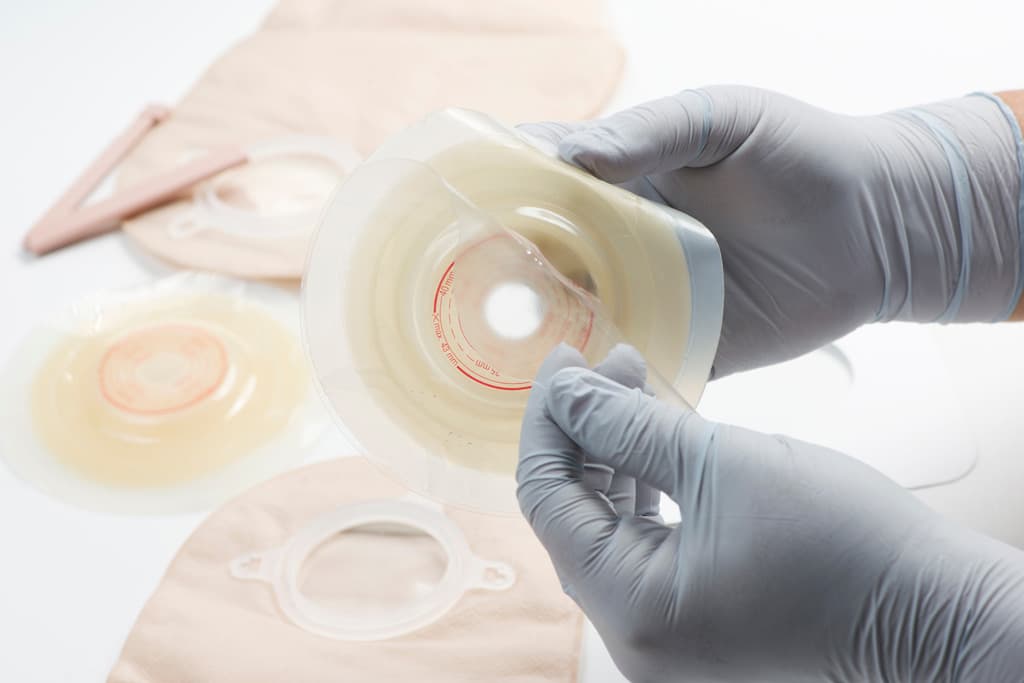 Osmeusavós, especialistas en el cuidado de ostomías